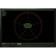 iZotope Insight  Essential Metering Suite(Serial Download)