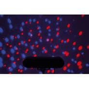 QTX PAR-T Bar - LED Party Bar and Stand Kit